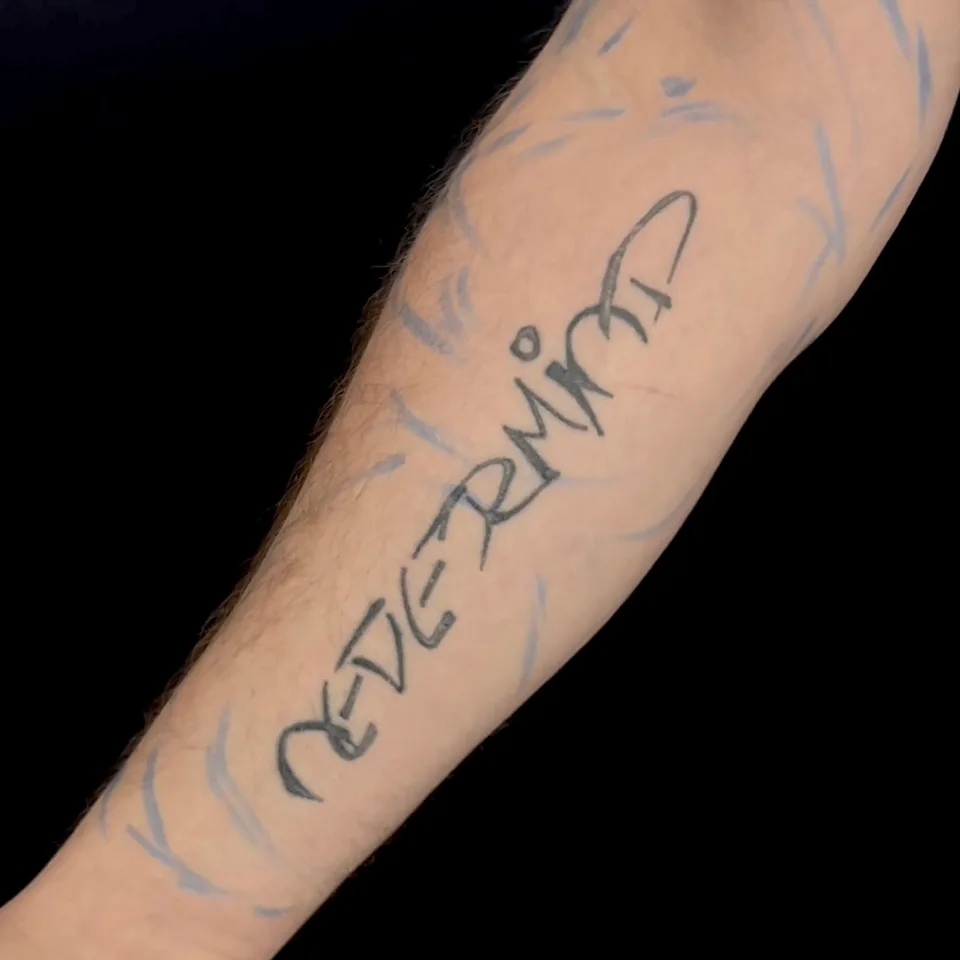 Vorher: ältere Schrift und Linien am Unterarm.